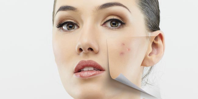 Banish the Appearence of Acne with Safe Make-up Tricks